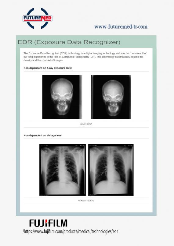 EDR (Exposure Data Recognizer)