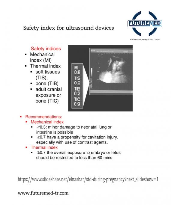 Safety index for ultrasound